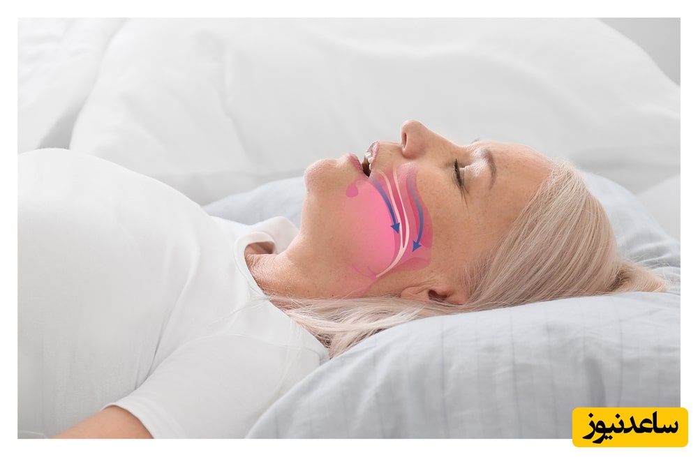 عوارض ناشی از خروپف کردن در بارداری