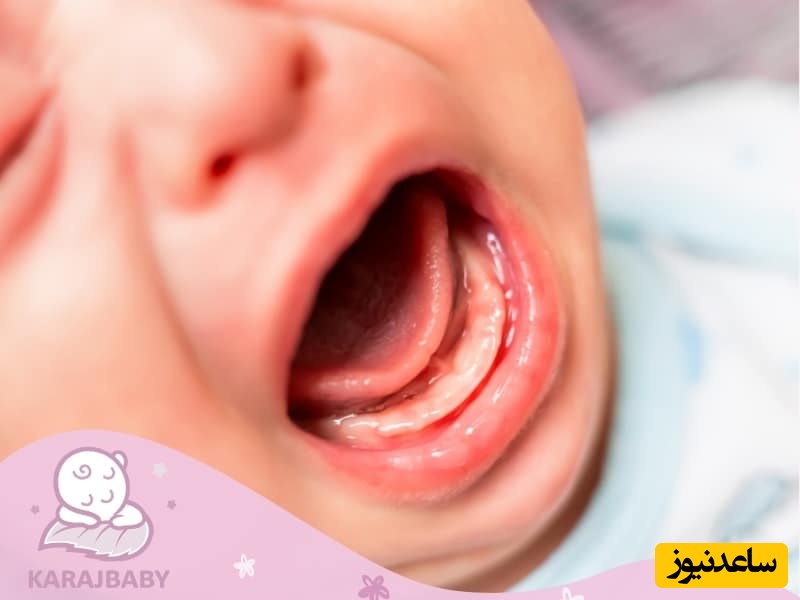 درمان های خانگی برای از بین بردن بوی بد دهان کودکان چیست؟