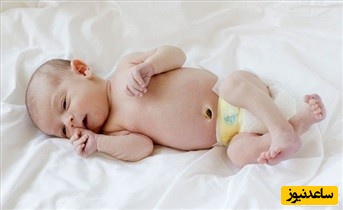 دلایل پیچیده شدن بند ناف دور گردن جنین