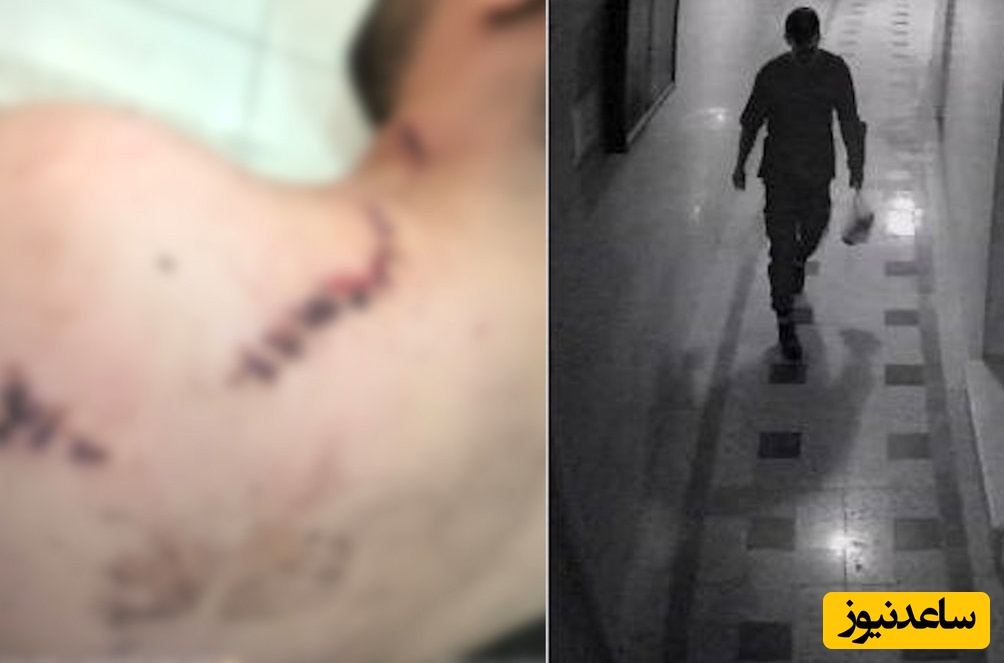 فیلم لحظه‌ وحشتناک از آتش‌افروزی و حمله خونین یک ناشناس به خانه یک جوان تهرانی/ ببین چطوری مثل آب خوردن وارد خونه شده