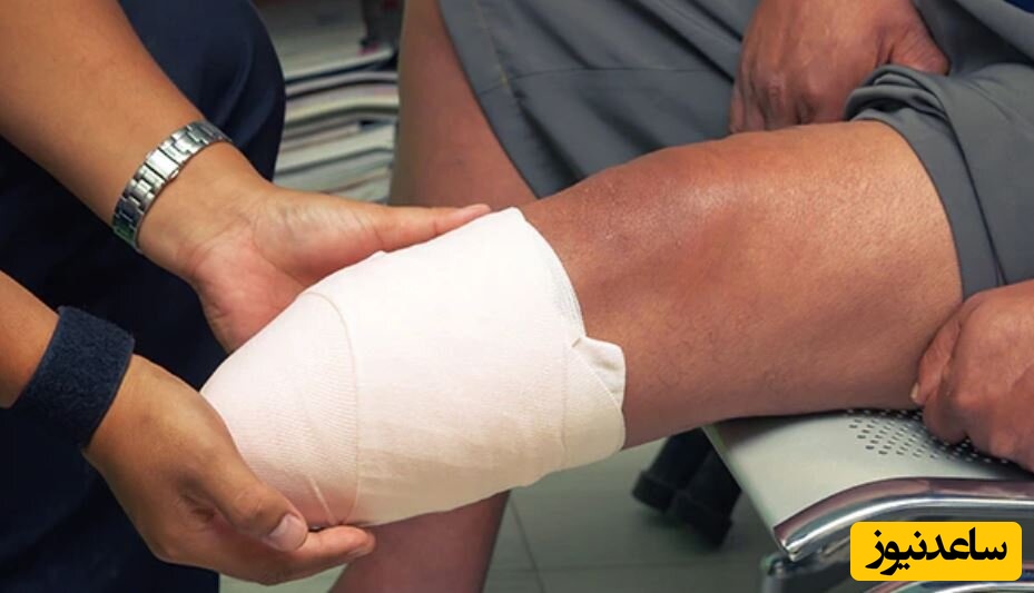 ماجرای عجیب قطع کردن پا برای ورود به دانشکده پزشکی