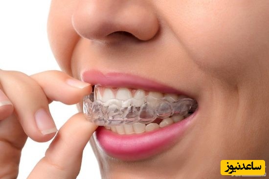 آیا ارتودنسی فقط برای فک پایین عوارضی دارد؟