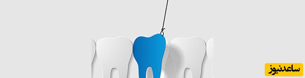 انتخاب رنگ مناسب لمینیت دندان