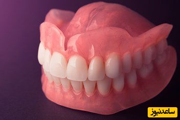 پروتز های ثابت دندان + نکات مهم