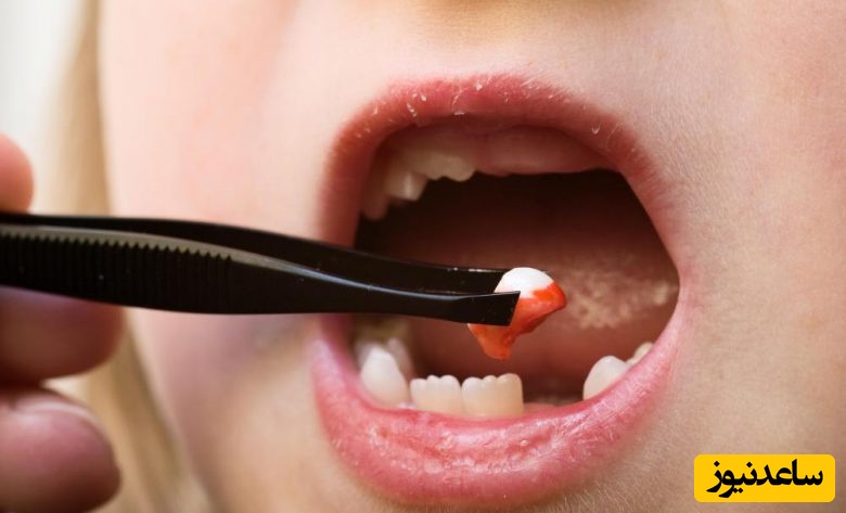 درمان درای ساکت چیست؟