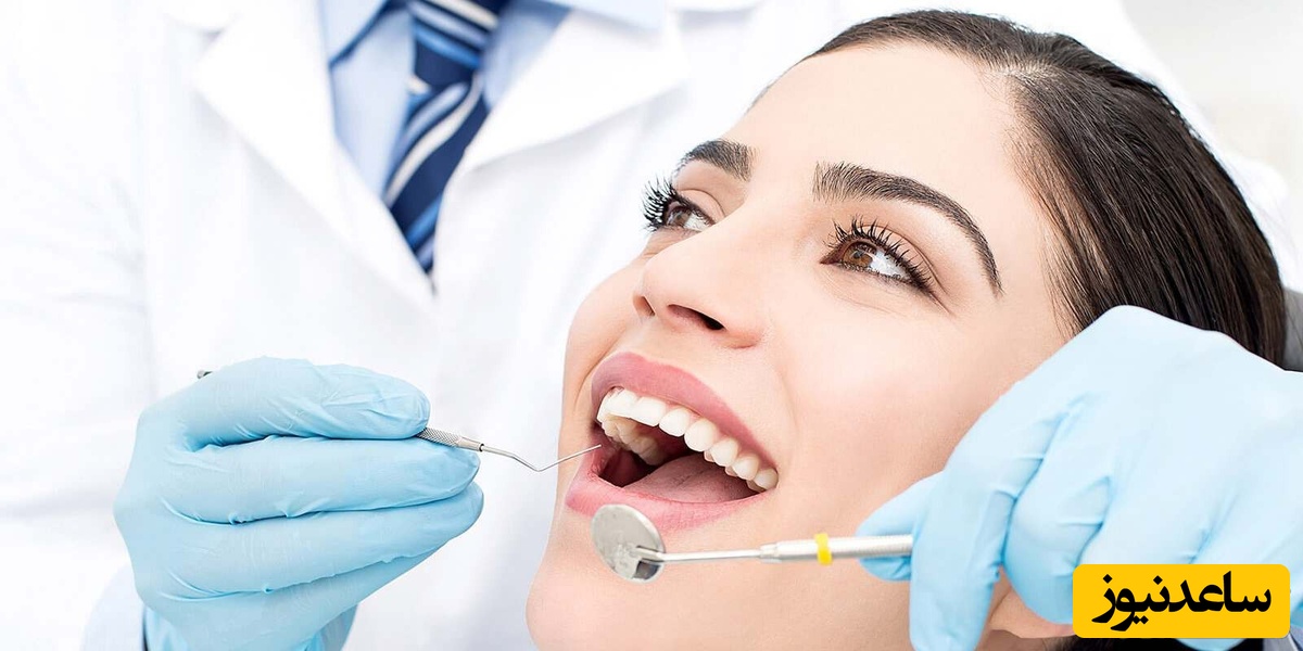 انواع جنس روکش دندان چیست؟