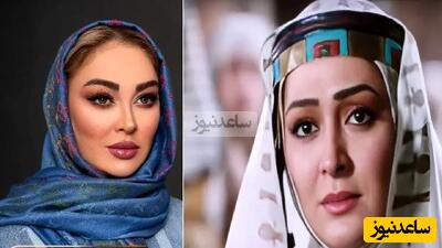 الهام حمیدی: من دوست ندارم فیلر بزنم یا گونه بذارم؛ ما باید روند پیریمون رو جلو بریم ولی... +ویدیو