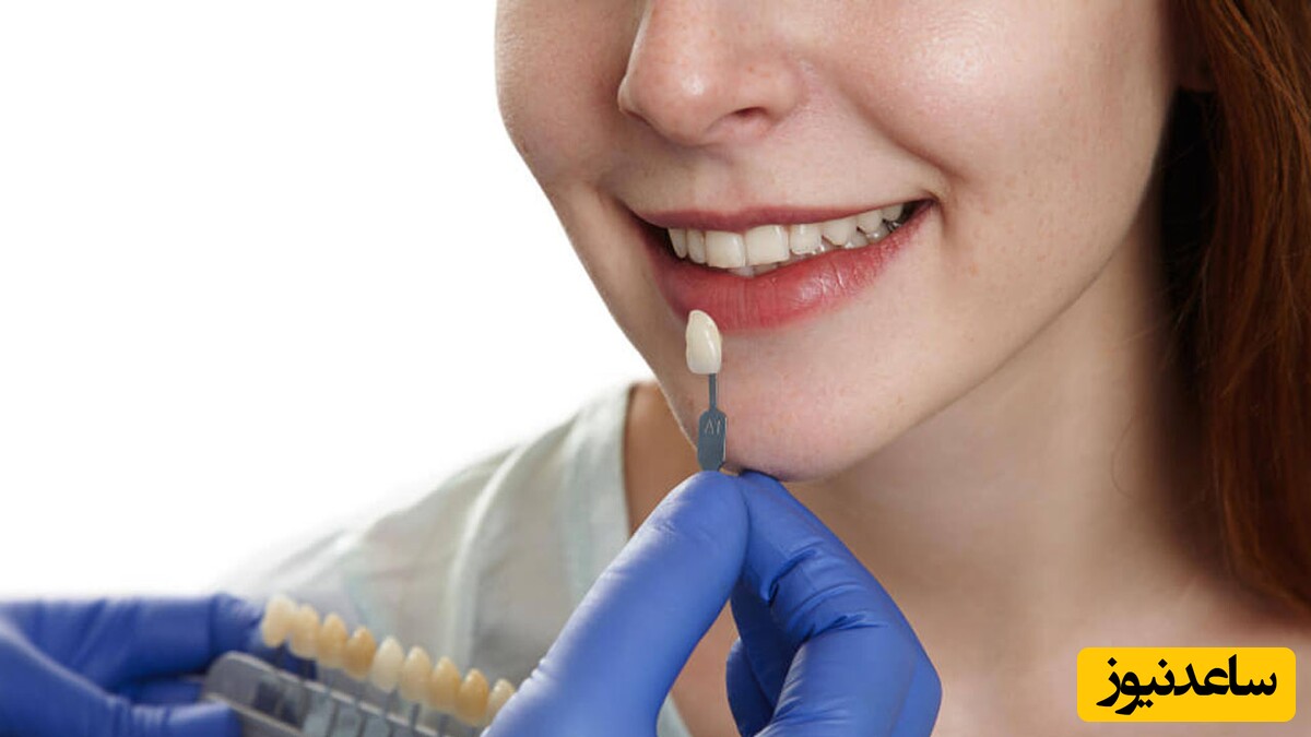 پروتز دندان چیست؟ و چه کمکی به رفع مشکلات دندان می کند؟