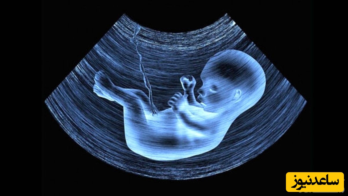 روش های جلوگیری از تولد نوزاد معلول