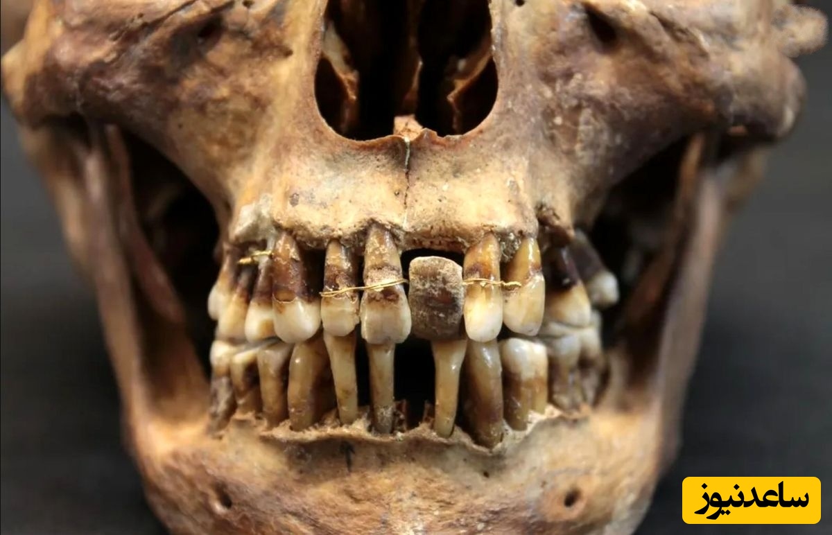 کشف راز جمجمه‌های 2 هزارساله با دندان‌های سیاه + عکس