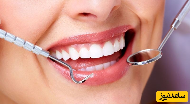 بعد از عصب کشی چه باید کرد؟