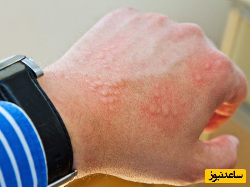  لووفلوکساسین