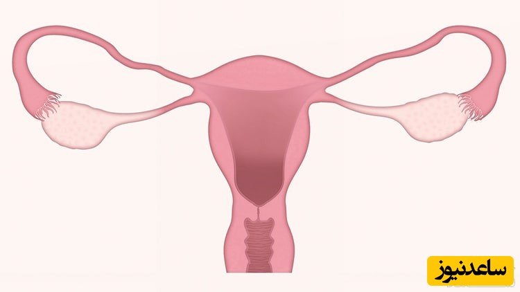 نمونه برداری از رحم چگونه انجام می‌شود؟