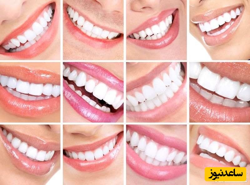 روش های گیاهی و کم هزینه برای رفع سیاهی لثه