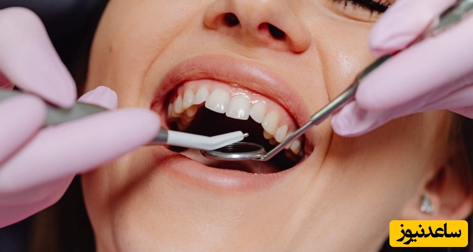 درمان های خانگی لثه پیوره