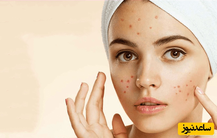 آیا رابطه جنسی باعث زیباتر شدن پوست می‌شود؟