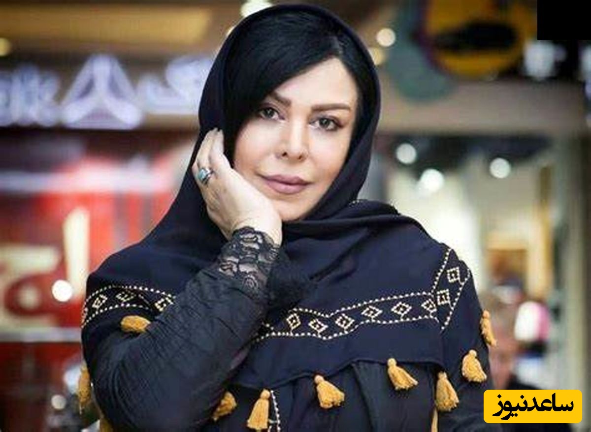 یک بیفور اَفتر باورنکردنی و دیده نشده از فلور نظری/ چه تغییری کرده! نمیشه اصلا شناختش!