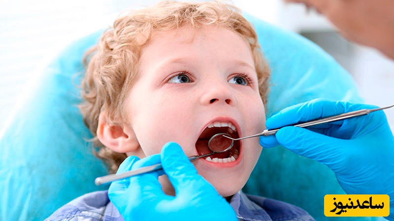 عوارض جانبی بعد از کشیدن دندان شیری کودک چیست؟