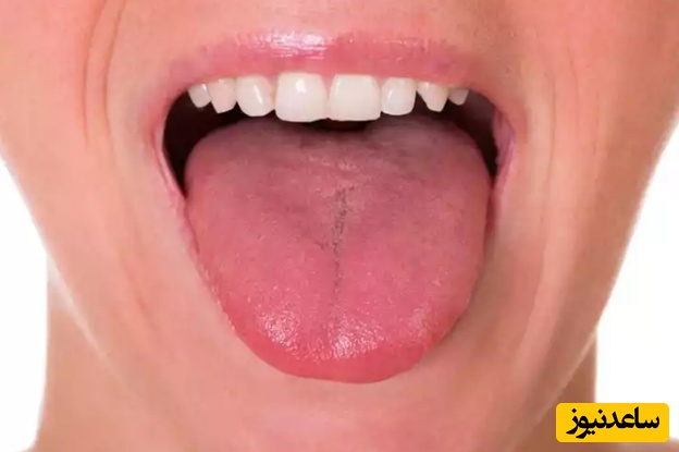 برای جلوگیری از ایجاد طعم فلز در دهان چه کارهایی میتوان انجام داد؟