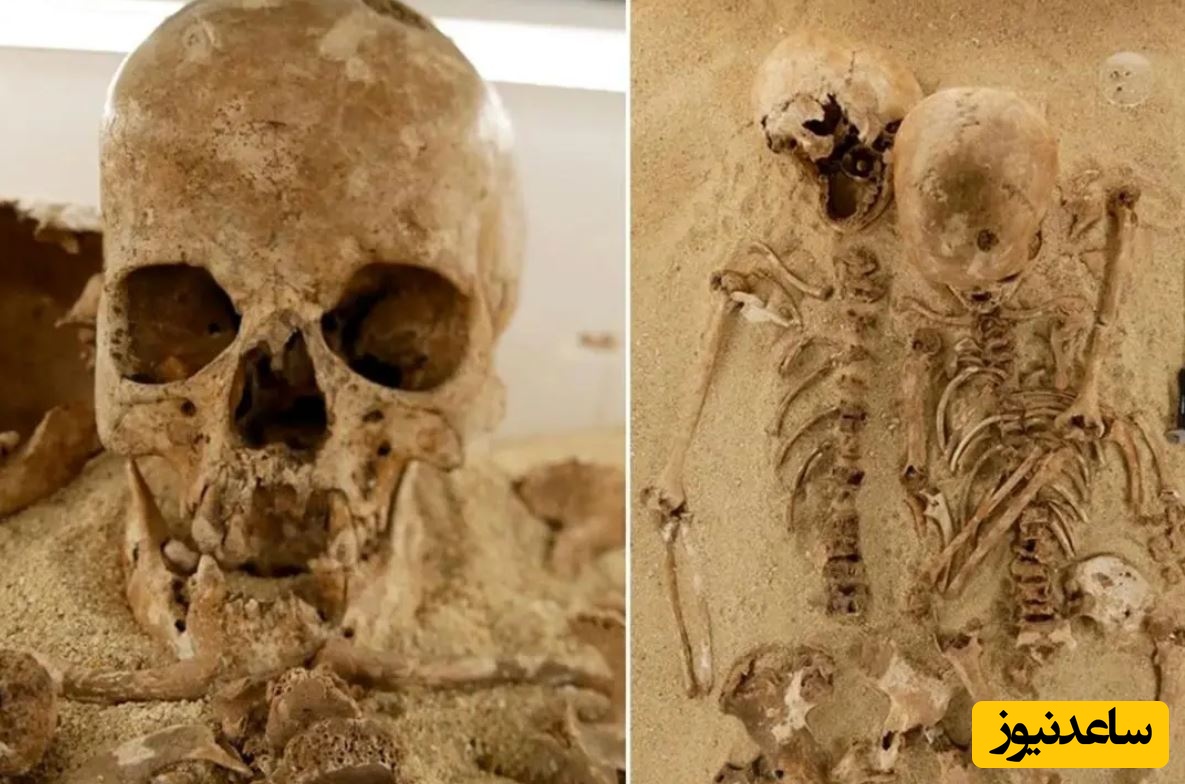 تشخیص یک بیماری ژنتیکی نادر در «اسکلت 12 هزارساله»