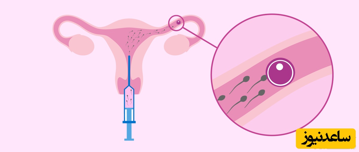 اندام زنانه