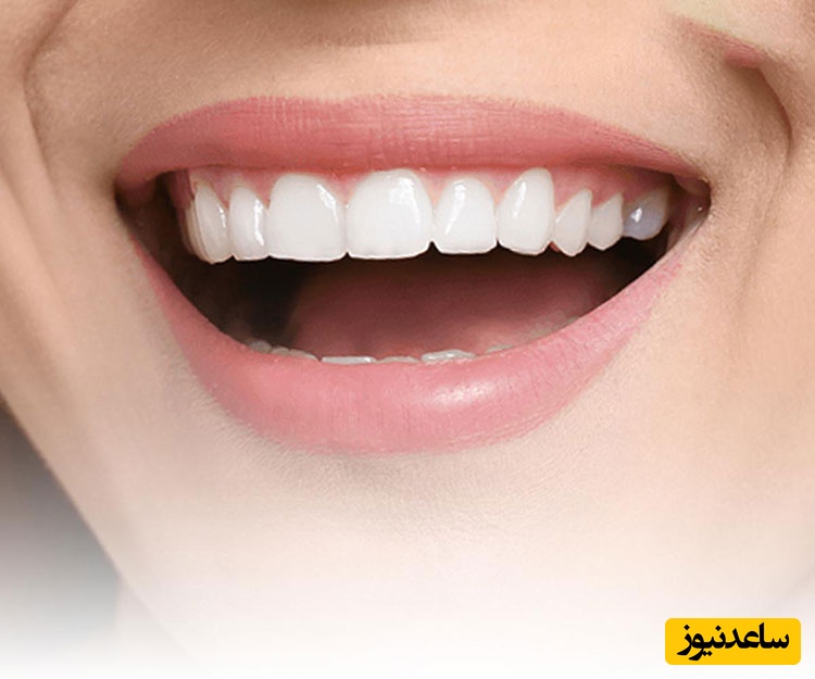 اصلاح طرح لبخند در چه کسانی بهتر است انجام شود؟