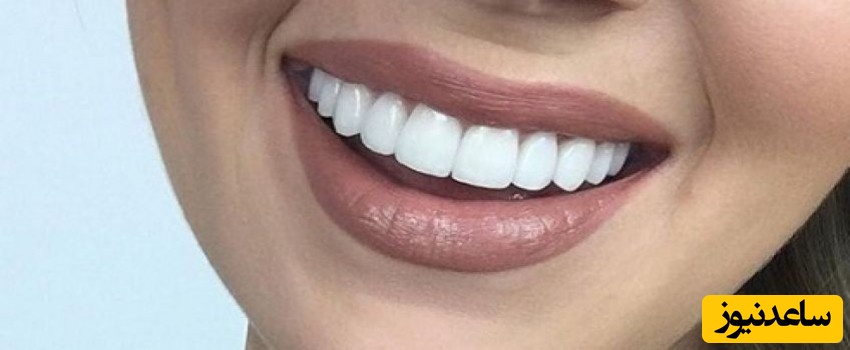 مشکلات رایج دندان عقل