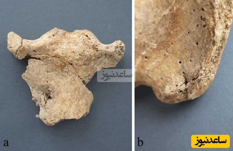 (A) زخم سوراخ‌شده در بخش جلویی استخوان جناغ، (manubrium) مربوط به اسکلت SK 4، (B) زخم سوراخ‌شده در بخش پشتی استخوان لگن راست مربوط به اسکلت SK 5. این افراد قربانی طاعون یا قحطی نبودند، بلکه مردانی بودند که با شمشیر زیستند و با شمشیر مردند