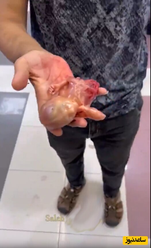 (+18) ویدئویی تلخ و باورنکردنی از یک جنین در دستان پدرش / وحشی گری صهیونیست ها دامن زنان باردار را هم گرفت!