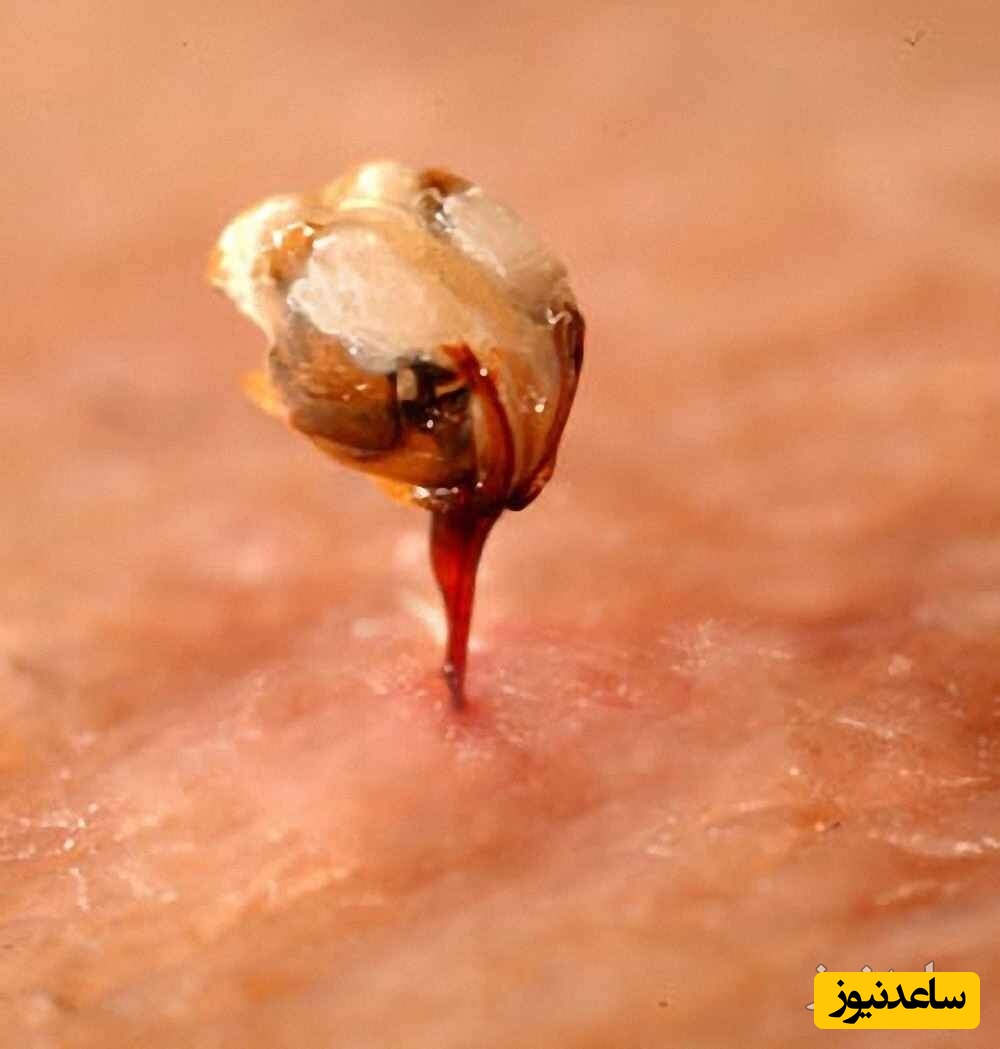 صحنه ای خارق العاده از نحوه نیش زدن زنبور