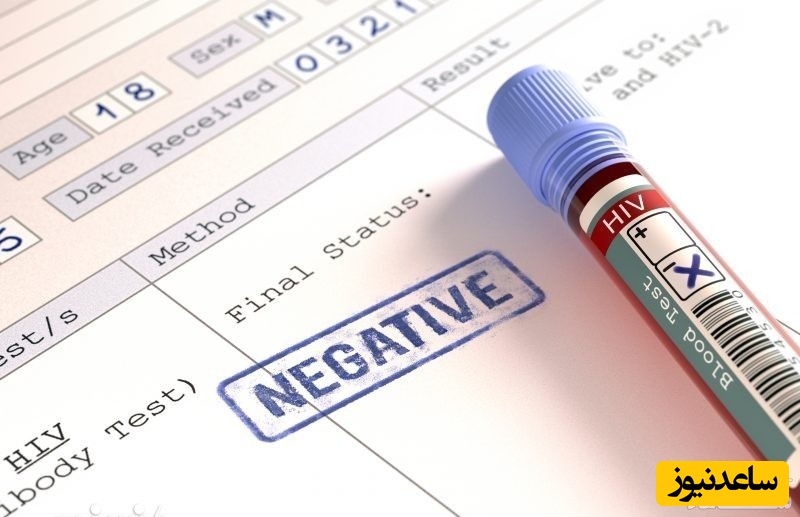 انجام آزمایش ایدز در چه شرایطی ضروری و لازم است؟