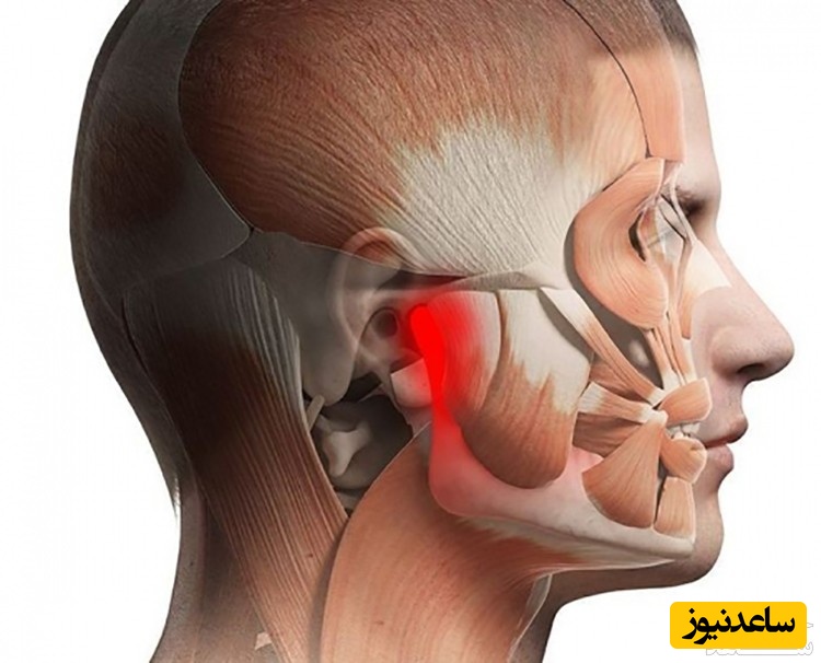 پیشگیری از درد فک چگونه امکان پذیر است؟