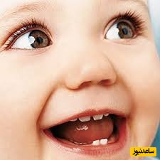 درمان دارویی برفک دهان نوزاد چیست؟