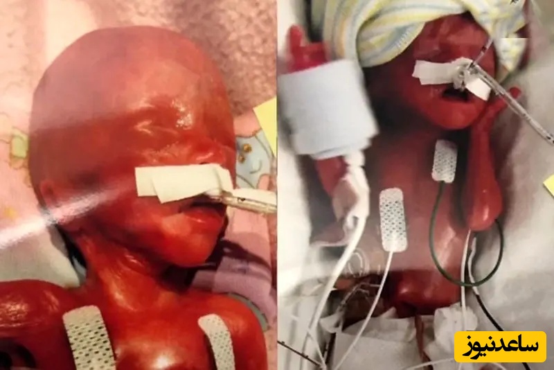 عجیب و غریب‌ترین زایمان‌ تاریخ !! / این زن سیب قرمز زایید + عکس