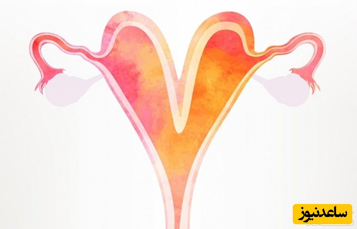 تاثیر دو شاخه بودن رحم بر بارداری