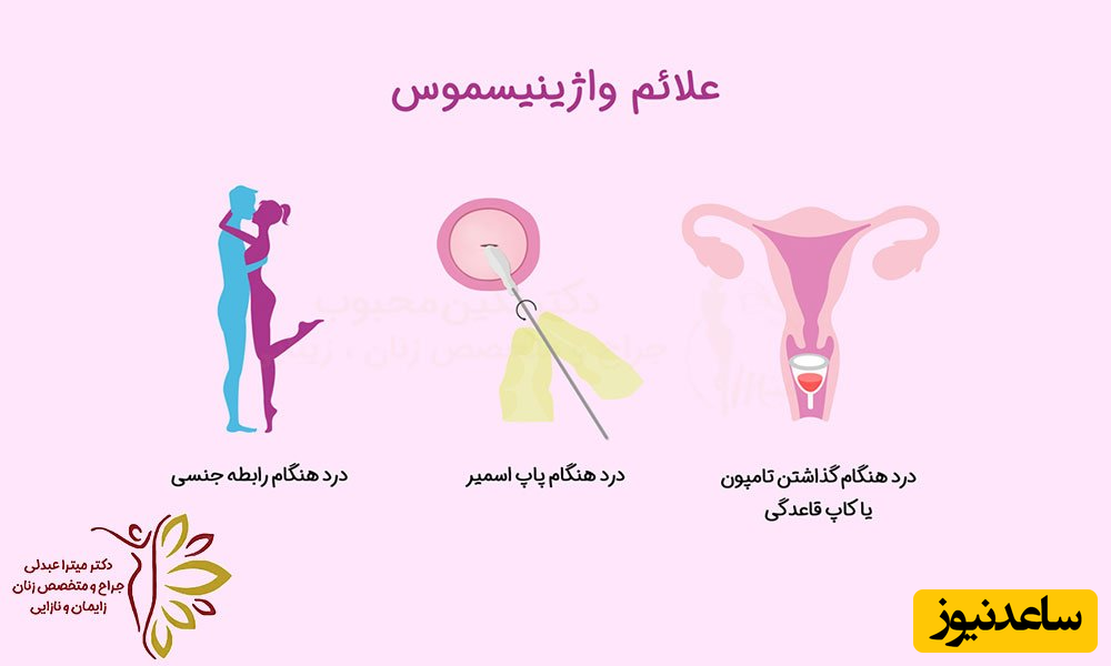 اختلال واژینیسموس و راه های درمان آن