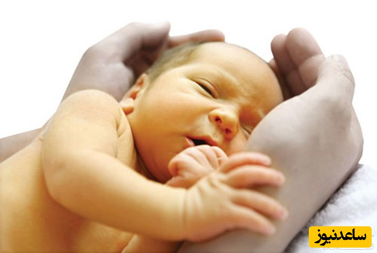 درمان زردی نوزاد با شیر خشت