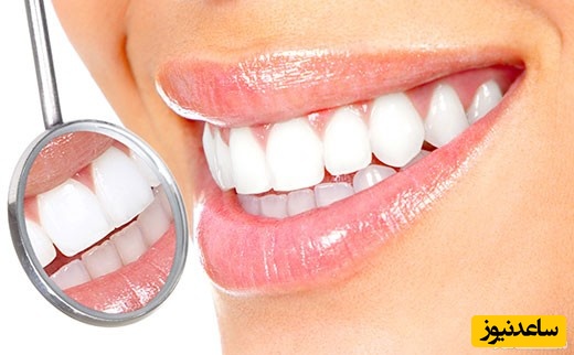 چگونه دندان های سفید داشته باشیم؟