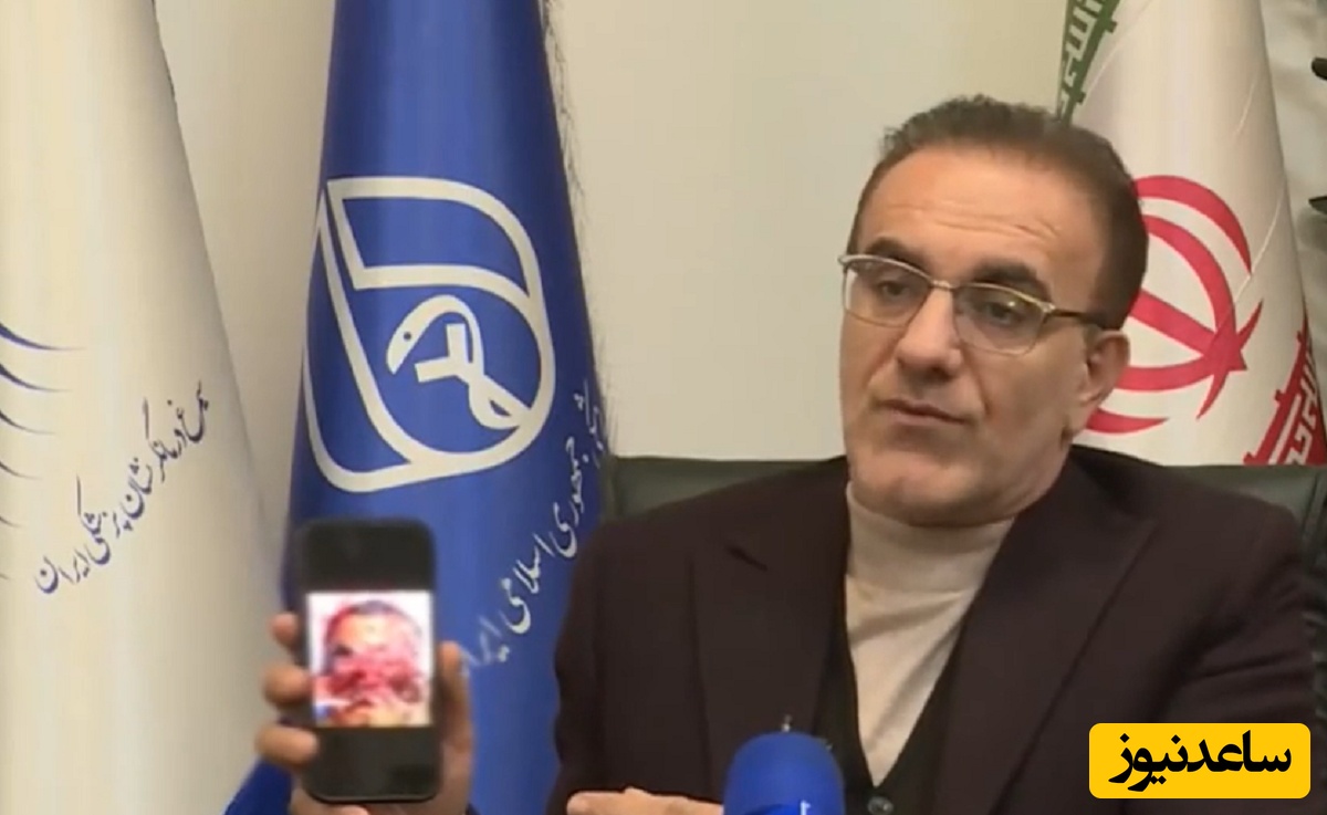 (فیلم) تعجب رئیس نظام پزشکی از آسیب‌های مجروحان: این کار اغتشاشگران نیست؛ نارنجک را در صورت فرد منفجر کرده‌اند