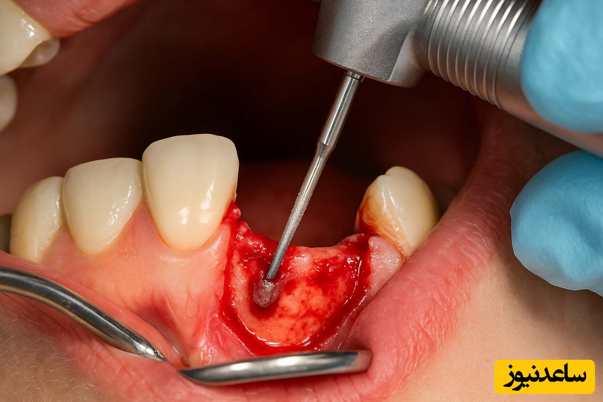 درد ریشه ی دندان را چگونه میتوان کنترل کرد؟