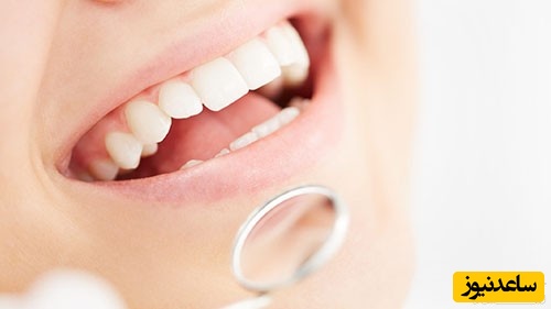 ورم لثه و راه های درمان آن