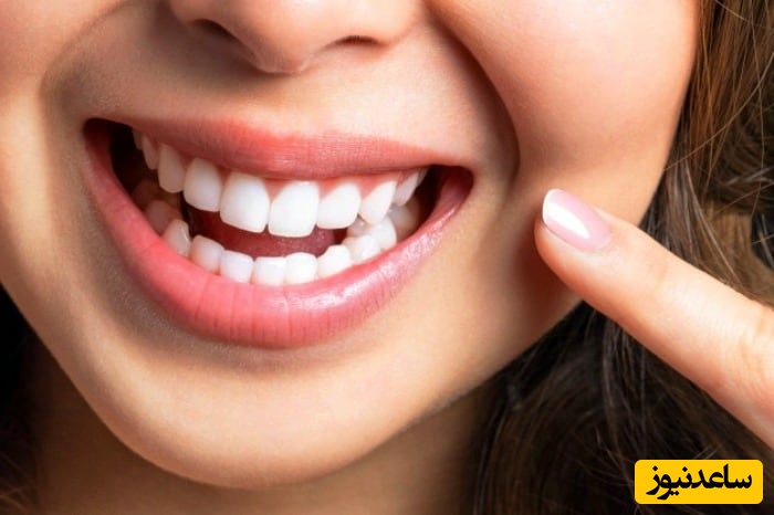 بهترین روش سفید کردن دندان ها برای بزرگسالان