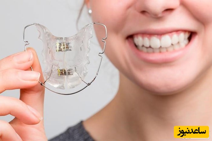 مال اکلوژن چیست؟