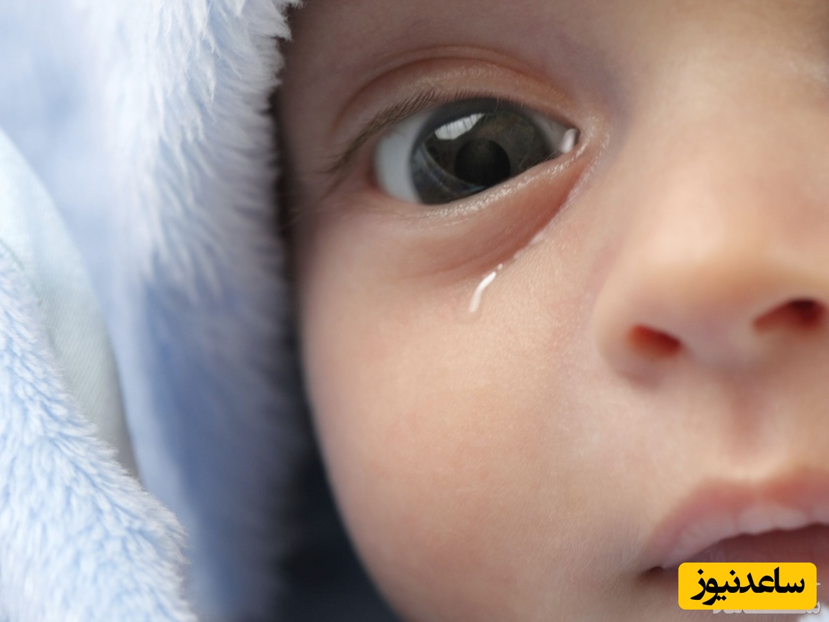 علائم انسداد مجرای اشکی در کودکان و راه تشخیص و درمان آن چیست؟