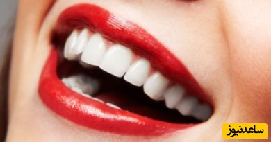 زبان سیاه مودار چیست؟