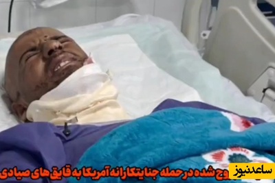اولین صحبتهای مجروح حمله روز گذشته آمریکا به قایق صیادی؛ جوانی که از شدت درد به سختی این مصاحبه را انجام داد+فیلم