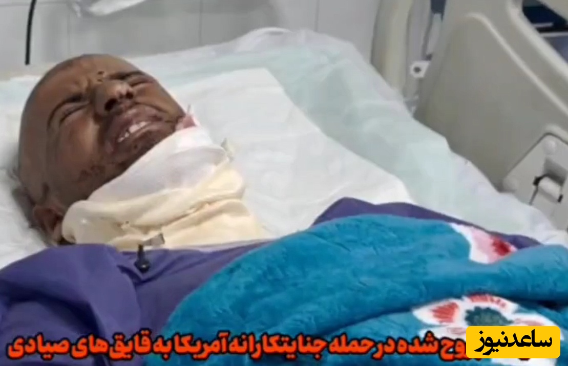 اولین صحبتهای مجروح حمله روز گذشته آمریکا به قایق صیادی؛ جوانی که از شدت درد به سختی این مصاحبه را انجام داد+فیلم
