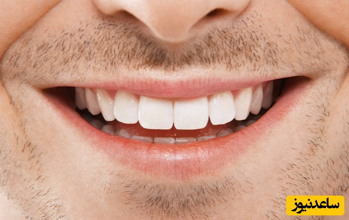 خدمات دندانپزشکی شامل چه مواردی است؟