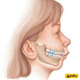 اوربایت چگونه درمان می شود؟