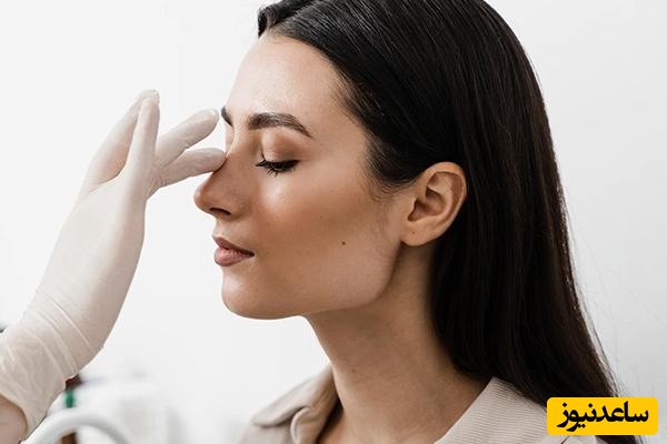 تعیین بهترین سن برای عمل بینی باتوجه‌به گوشتی یا استخوانی بودن